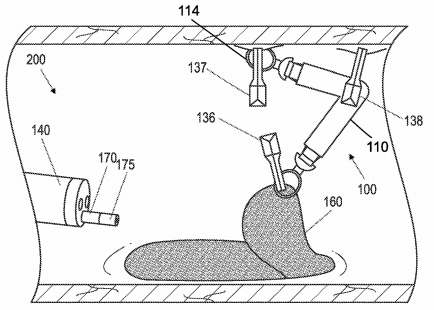 Boston Scientific Files a Patent for Tissue Retraction Bands