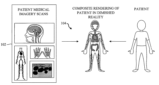Composite Imagery Rendering in Diminished Reality Environment for Medical Diagnosis