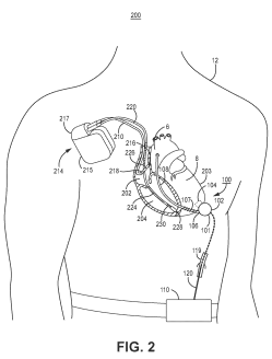 Medtronic Files a Patent for a Ventricular Assist Device and a Cardiac Electrical Stimulation System for Therapy Control
