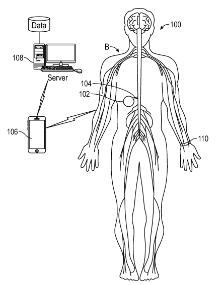 Method to Detect the Inadvertent Delivery of a Drug to a Subcutaneous Pocket